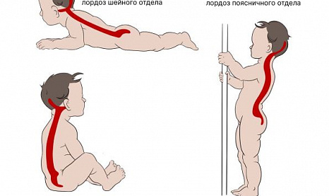 Йогатерапия позвоночника. Нарушения осанки (грудной гиперкифоз)